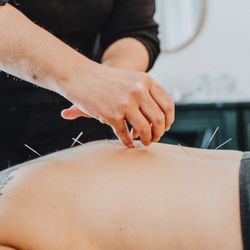 Soul Space - Acupuncture
