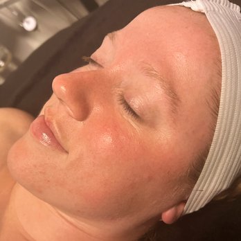Sydney Lin - Right after a fresh dermaplaning facial with CBD infused products - Estheticians Near Me - Middletown, New York Sydney Lin - Right after a fresh dermaplaning facial with CBD infused products - Estheticians Near Me - Middletown, New York