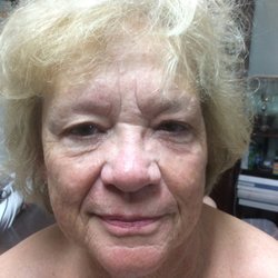 R5 Skinworks - After