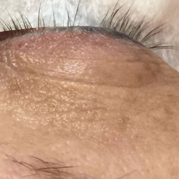 Angela Beauty Studio - This photo is before I visited Angela. I had bald spots and they were barely noticeable - Eyelash Service Near Me - Norco, California