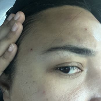 Lively Lash & Beauty - She used tissue paper to squeeze the blackheads out of my skin all over my face. - Skin Care Near Me - Pacifica, California Lively Lash & Beauty - She used tissue paper to squeeze the blackheads out of my skin all over my face. - Skin Care Near Me - Pacifica, California