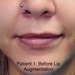 Beau Visage Aesthetic Center by Anthony R. Bittar, MD