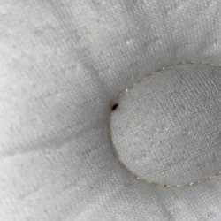 Lakeview Hecla Resort - Bed bug ?