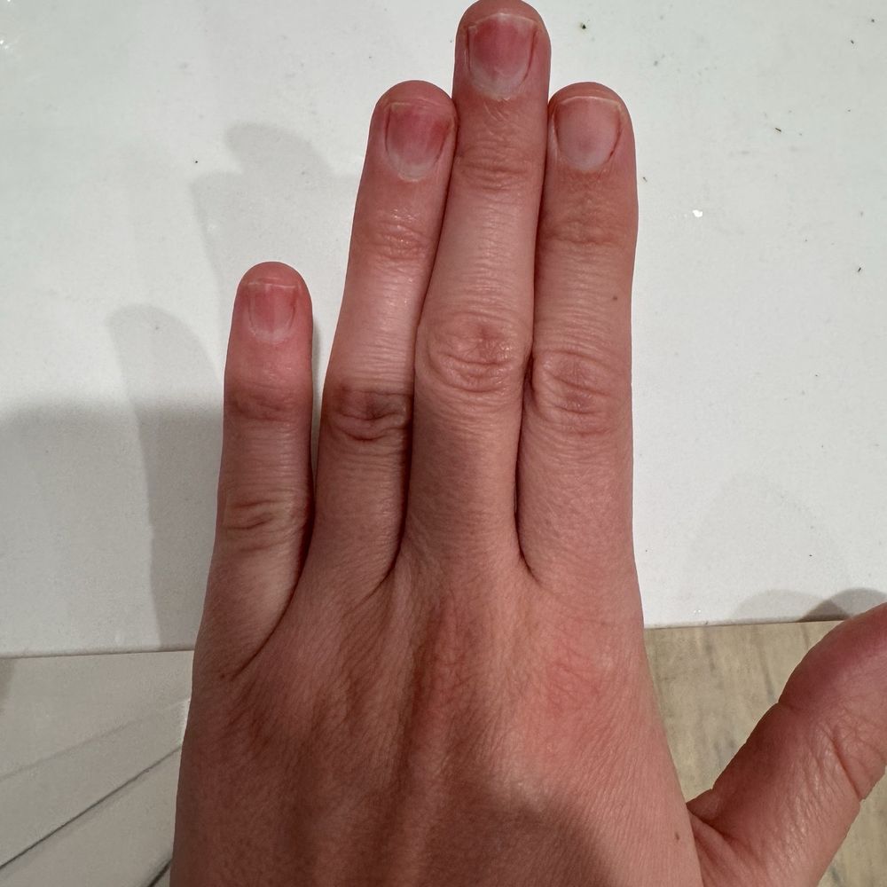 Cha Spa - My nails after my gels were removed and she buffed my nails down - Nail Salons Near Me - Santa Monica, California