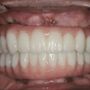 Manhattan Arch Implant Center