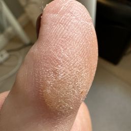Final product after paying for callus remover..? Final product after paying for callus remover..?