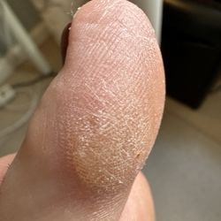 Queen Best Nail & Spa - Final product after paying for callus remover..?