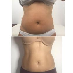 Destin Weight Loss and Wellness