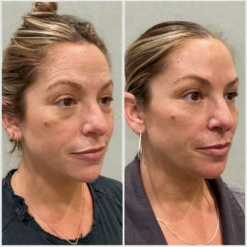Organic Skin Studio - Skin Care Near Me - Sacramento, California Organic Skin Studio - Skin Care Near Me - Sacramento, California