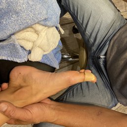 My double bandaged toe that they had to put some powder on to stop the bleeding My double bandaged toe that they had to put some powder on to stop the bleeding