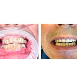 405 Implants & Dentures