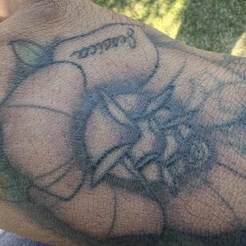 Rising Phoenix Tattoo - Scarring color fading - Tattoo Near Me - Addison, Illinois