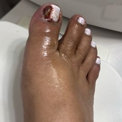 A Nails - Un mal trabajo