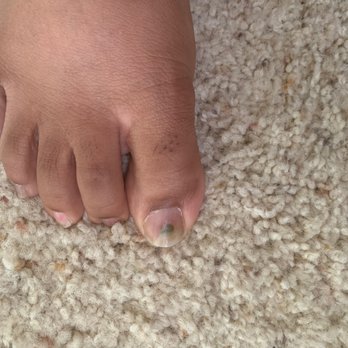 Still have cuticle after pedicure and fighting a fungus due to implements not being properly sterilized.