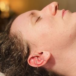Sacred Esthetics - Benefits of NADA (  Acupuncture )

*reduces cravings 
*relief from stress / emotional trauma
* increased calmness
*detoxes organs
