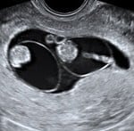 Center For Fetal Medicine and Women's Ultrasound - patient advocate in Los Angeles, CA