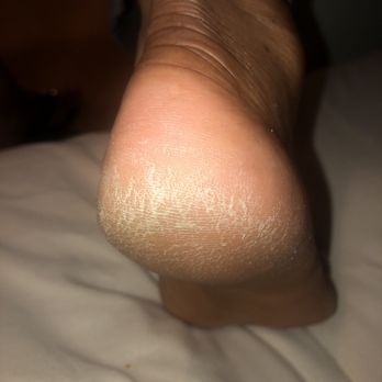 Numi Nails & Spa - Heels not scrubbed at all - Nail Salons Near Me - Hillsdale, New Jersey Numi Nails & Spa - Heels not scrubbed at all - Nail Salons Near Me - Hillsdale, New Jersey