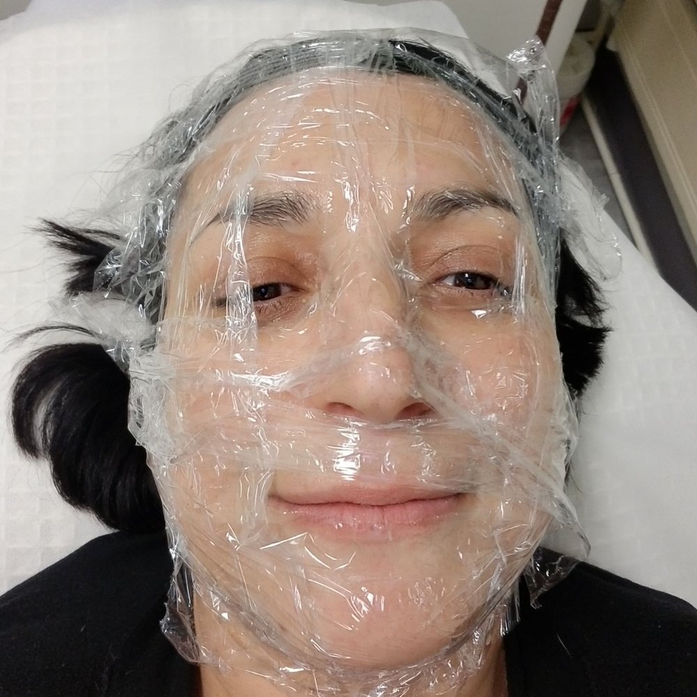 Glo Spa NY - Fibroblast plasma facial - Laser Hair Removal Near Me - New York, New York Glo Spa NY - Fibroblast plasma facial - Laser Hair Removal Near Me - New York, New York
