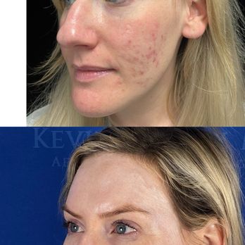 健康・医学 aesthetic plastic surgery of the east Aesthetic Plastic Surgery of the East Asian Face