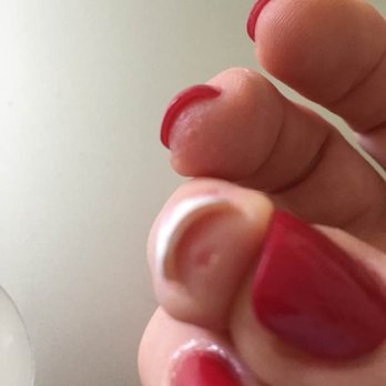 Creative Nails & Spa - Worcester - Manicurist filed my nails so low, she nicked the top of my finger. - Nail Salons Near Me - Worcester, Massachusetts Creative Nails & Spa - Worcester - Manicurist filed my nails so low, she nicked the top of my finger. - Nail Salons Near Me - Worcester, Massachusetts