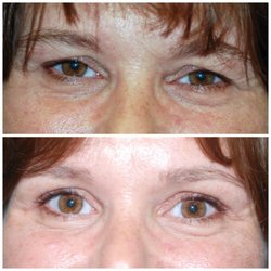 Steven Covici, MD, FACS - Before and After Results from Steven Covici, MD, FACS | Springfield,  MA