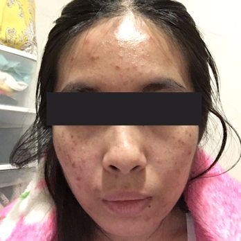 Ageless MD - Before photo on Feb 3rd, 2019 - Medical Spas Near Me - Tustin, California Ageless MD - Before photo on Feb 3rd, 2019 - Medical Spas Near Me - Tustin, California