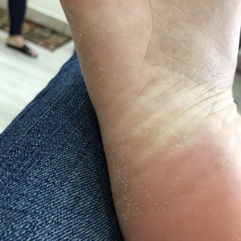 Uptown Nail Salon - sorry to post my dirty feet but this is what i left with. - Nail Salons Near Me - San Diego, California Uptown Nail Salon - sorry to post my dirty feet but this is what i left with. - Nail Salons Near Me - San Diego, California