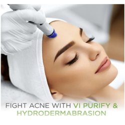Epic Aesthetics - Acne treatments