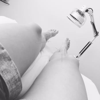 The Tortoise Clinic - Nothing to see here, just a few needles in my legs. - Acupuncture Near Me - Santa Rosa Beach, Florida