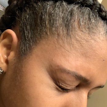 Nia Soule Salon - Flaky product - Hair Extensions Near Me - Norcross, Georgia
