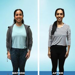 Svelte Medical Weight Loss Centers - Svelte Transformation