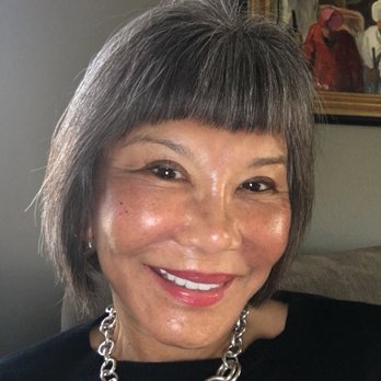 Highly Artistic Surgery - Five days after IPL. Only blush, no other face makeup. - Cosmetic Surgeons Near Me - Poway, California Highly Artistic Surgery - Five days after IPL. Only blush, no other face makeup. - Cosmetic Surgeons Near Me - Poway, California