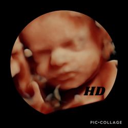 Baby Dimensions - #awesomeimage of a #29week baby in #hd, lots of #greathydration to get #images this clear.