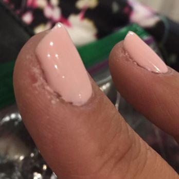 Aloha Nail - Skin is so dry & raw after. She kept cutting. This one hurts so bad. - Nail Salons Near Me - Las Vegas, Nevada Aloha Nail - Skin is so dry & raw after. She kept cutting. This one hurts so bad. - Nail Salons Near Me - Las Vegas, Nevada