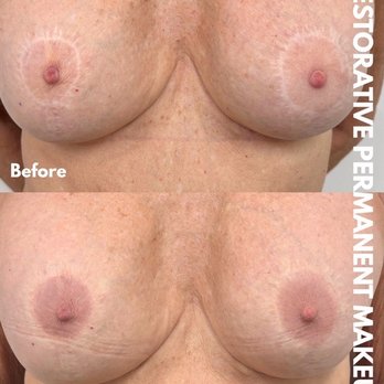 Restorative Permanent Makeup - Scar camouflage - Permanent Makeup Near Me - La Jolla, California Restorative Permanent Makeup - Scar camouflage - Permanent Makeup Near Me - La Jolla, California