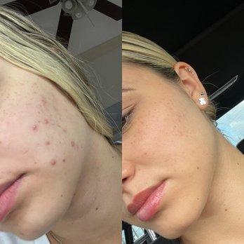 Skin Glow x Steph - Skin Care Near Me - Miami, Florida Skin Glow x Steph - Skin Care Near Me - Miami, Florida