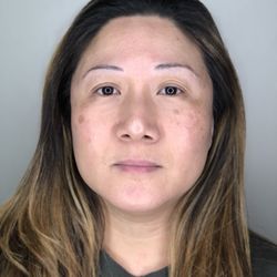 Brow & Line - BEFORE