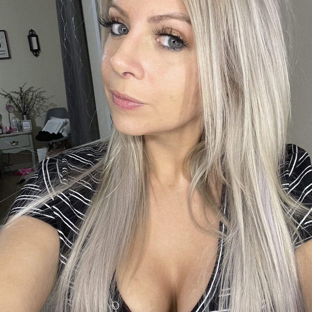 Andres Bustillo, MD, FACS - After! 6 Days post-op - Plastic Surgeons Near Me - Miami, Florida