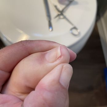 Bellagio Nail Bar - Toe nail cut on side. Can lead to ingrown toenail. - Nail Salons Near Me - San Antonio, Texas Bellagio Nail Bar - Toe nail cut on side. Can lead to ingrown toenail. - Nail Salons Near Me - San Antonio, Texas