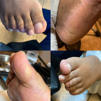 Healing Soles - after the wellness pedicure #drypedicure #CMNT #medicalnailtech specializing is pedicures for those who are at risk  #diabeticfootcare - Nail Technicians Near Me - Norco, California