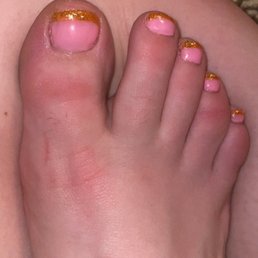 Badly painted. Notice the left side if big toe. Uneven coating Badly painted. Notice the left side if big toe. Uneven coating