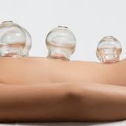 Cascade Massage Therapy - Massage Cupping