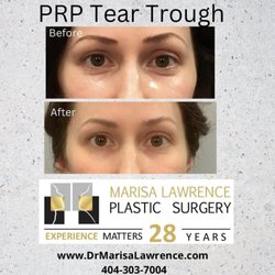 Marisa Lawrence, MD, FACS