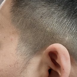 Not trimmed