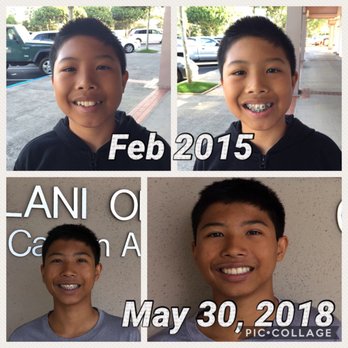 Mililani Orthodontics - Orthodontists Near Me - Mililani, Hawaii