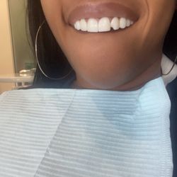 Friendly Dental Group of South Park - The chip