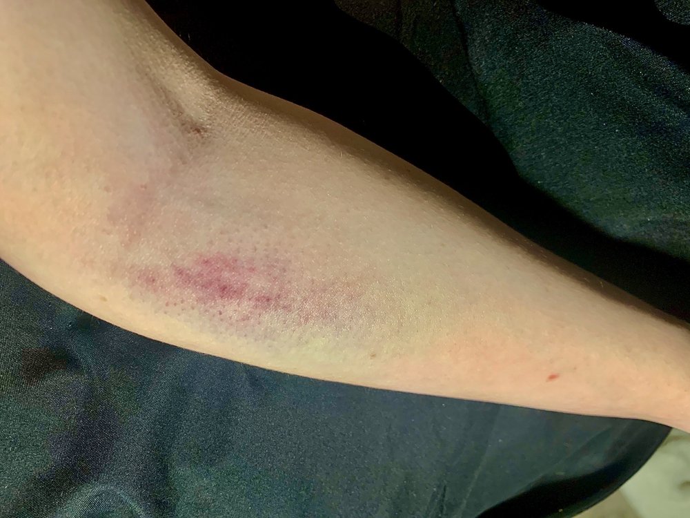 MERCY HOSPITAL 23 Photos & 63 Reviews 4050 Coon Rapids Blvd, Coon