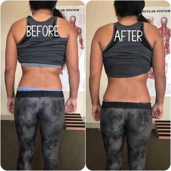 V'z Sports Therapy - PAIN MGMT CASE: R low back & hip pain, after improperly lifting.
ASSESS: strained R QL muscle, weak glutes & core
TREAT: bodywork & HEP - Fitness & Instruction Near Me V'z Sports Therapy - PAIN MGMT CASE: R low back & hip pain, after improperly lifting.
ASSESS: strained R QL muscle, weak glutes & core
TREAT: bodywork & HEP - Fitness & Instruction Near Me