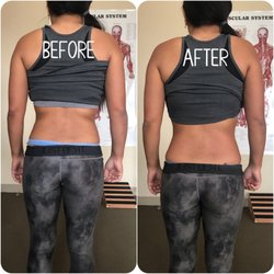 V'z Sports Therapy - PAIN MGMT CASE: R low back & hip pain, after improperly lifting.
ASSESS: strained R QL muscle, weak glutes & core
TREAT: bodywork & HEP