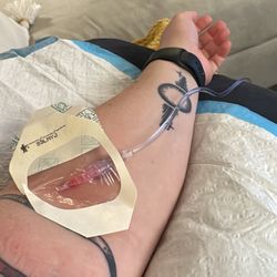 IV Bird